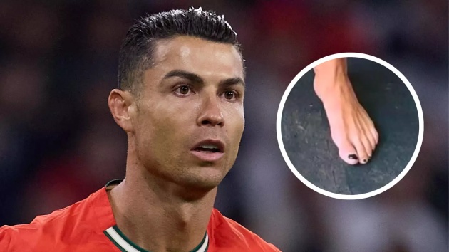 Chiến lược khôn ngoan! Lý do Ronaldo sơn móng chân màu đen 695ca7905550f.jpeg